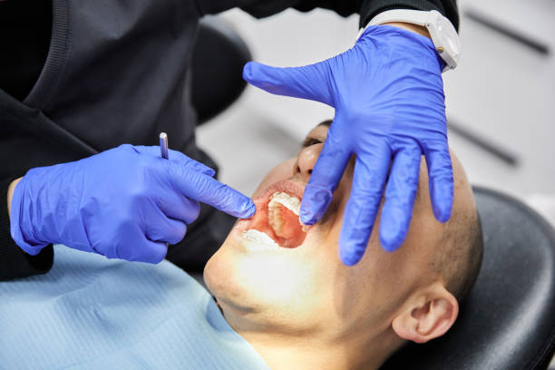 Best Emergency Treatment for Toothache in Mansfield, MO