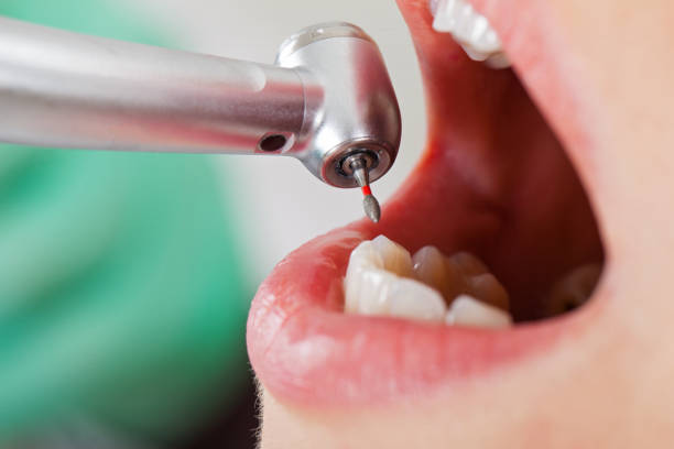 Best Emergency Dental Care for Trauma or Injury in Mansfield, MO